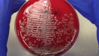 Plate Reading  Urine I [upl. by North]