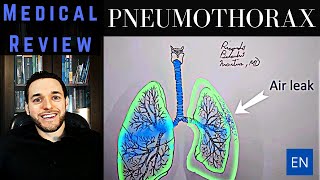 Pneumothorax Pathophysiology Pleura pleural space and positive pressure [upl. by Inavoy245]