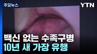 백신 없는 수족구병 10년 새 가장 유행  YTN [upl. by Rfinnej]