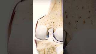 Movement of menisci anterior and posterior cruciate ligament of kneeshortsmedicosshort [upl. by Aihsa16]