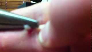 how to remove a wart [upl. by Denison]