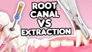 Root Canal vs Tooth Extraction What’s the Right Choice [upl. by Ainimreh]