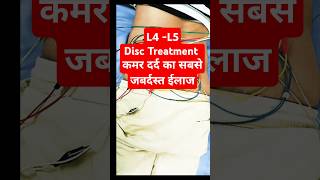 कमर दर्द ठीक करने का जबर्दस्त ईलाज physiotherapy acupuncture shortvideo [upl. by Backer]