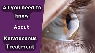 Essential Keratoconus Treatment Options Every Patient Needs to Know  علاج القرنية المخروطية [upl. by Gnoud]