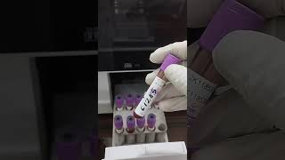 CBC Blood test যেভাবে CBC রক্ত পরিক্ষা করা হয়। [upl. by Elonore30]