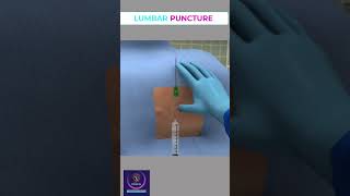 Lumbar Puncture Basic Skills shorts [upl. by Sidky]