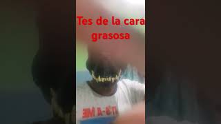 Tes de la cara grasosa [upl. by Fita195]