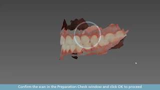 CS Imaging 31  software de aquisição do scanner intraoral CS3600 [upl. by Ecnerolf829]