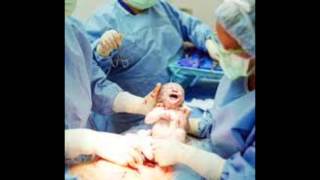 VIDEO TETANO NEONATAL [upl. by Nywrad]