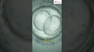 How IVFICSI is done  Infertility Treatment  Dr Rashmi Agrawal shorts [upl. by Dao298]