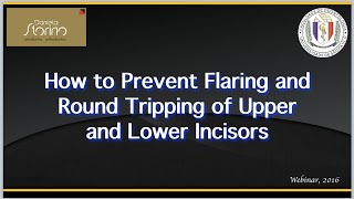 How to Prevent Flaring and Round Tripping [upl. by Hyde]