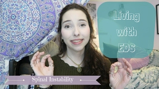 Living with EDS Spinal Instability [upl. by Moorish]