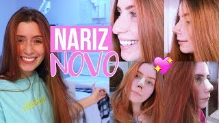 VLOG MINHA RINOPLASTIA CIRURGIA NO NARIZ [upl. by Haiel]