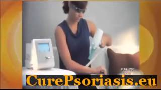 Vitamin C For Psoriasis [upl. by Ahsinirt]