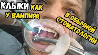 Делаю клыки как у ВАМПИРА  БОЛЬНО  сколько стоит [upl. by Howes602]