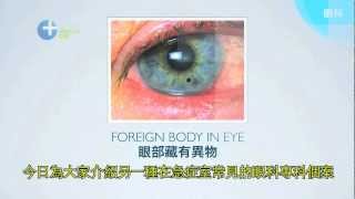 眼部藏有異物 Foreign body in eye [upl. by Ecirehs]