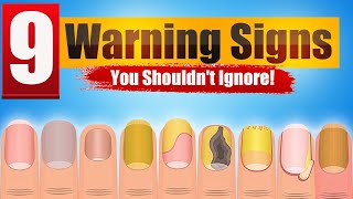 What Your Nails Tell About Your Health 9 Warning Signs  Healthy Buddy [upl. by Purington]