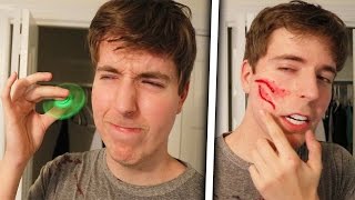 Fidget Spinner Vs Face Legit Had To Get Stitches [upl. by Suiram]