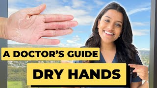 Dry hands Eczema 👋🏽 5 Tips for Smooth and Hydrated Hands 🙌 [upl. by Mccullough926]