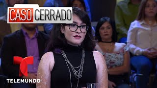 Discriminación Por Vitíligo🙅👎😭 Caso Cerrado  Telemundo [upl. by Kilar]