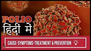 Polio DiseaseCauseSymptoms amp PreventionIn Hindi TheDarkestShow [upl. by Shelia]