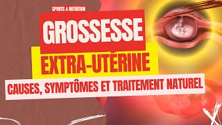 GROSSESSE EXTRAUTÉRINE  CAUSES SYMPTÔMES ET TRAITEMENTS NATUREL  SPORTS amp NUTRITION [upl. by Ahsilav456]