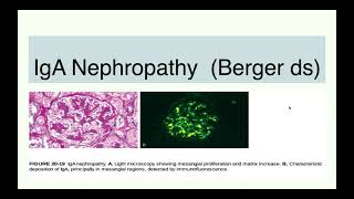 IgA Nephropathy  Berger disease [upl. by Anytsyrk]