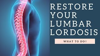 RESTORE Lumbar Lordosis amp The Curvature Of The Spine With These Exercises How To Demo [upl. by Ahsei352]