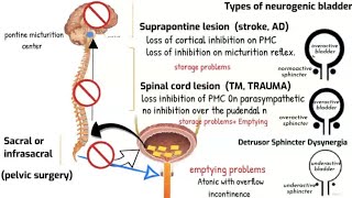 Neurogenic bladder and Micturition reflex [upl. by Laerol]