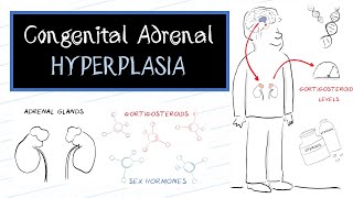 What is Congenital Adrenal Hyperplasia CAH [upl. by Imoyn]