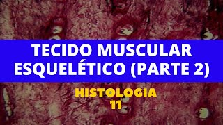 TECIDO MUSCULAR ESQUELÉTICO PARTE 2  HISTOLOGIA 11 [upl. by Natlus]