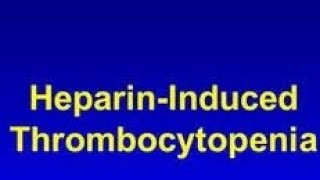 HEPARIN INDUCED THROMBOCYTOPENIA  HIT medical learnings  practical learnings [upl. by Einnaej640]