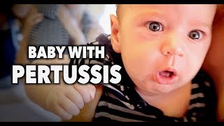 BABY WITH PERTUSSIS Whooping Cough  Dr Paul [upl. by Doretta]