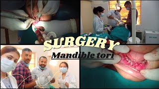 SURGERY Mandibular tori excision oral Surgery ⚕️dentist medical vlogyoutube [upl. by Akimit422]