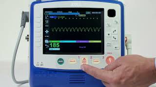 X Series® Synchronized Cardioversion English [upl. by Suhpoelc]