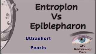 Entropion vs Epiblepharon│ Ultrashort Pearls 13 [upl. by Anyale]