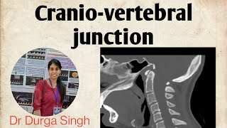 Craniovertebral junction Anatomy and Radiology [upl. by Coridon]