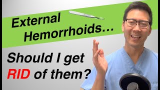 External hemorrhoid treatment Should I REMOVE or LEAVE them [upl. by Parsaye]