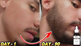 Beard growth  तीन महीने में दाढ़ी उगाए  man matters beard oil reviewman matters minoxidil review [upl. by Aivon]