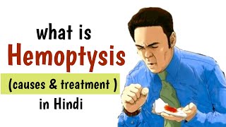 what is Hemoptysis  causes Diagnosis amp Treatment in Hindi hemoptysis [upl. by Nanni]