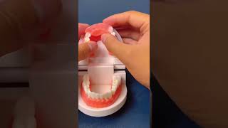 Youtooth be save money you worthy it🦷🦷repair teethtok cleaning smile [upl. by Neomah]