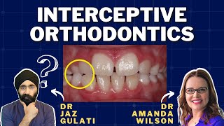 Interceptive Orthodontics for the General Dentist  PDP128 [upl. by Helge836]