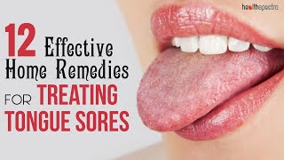 12 Effective Remedies For Treating Tongue Sores  Healthspectra [upl. by Nowed]