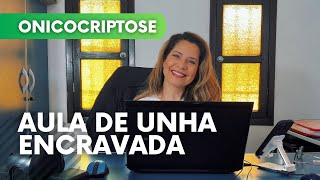 O QUE CAUSA UNHA ENCRAVADA   AULA DE ONICOCRIPTOSE  VIDEO 01 [upl. by Meredi]