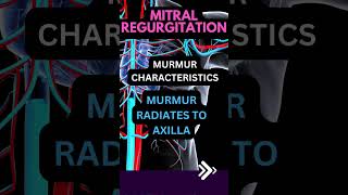 MITRAL REGURGITATION MURMURshorts [upl. by Ysnil]