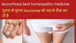 Leucorrhoea homeopathy treatmentLeucorrhoea homeopathy treatmentleucorrhoea Homeopathic medicine [upl. by Ahsimak]