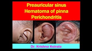 Preauricular sinus  Hematoma of pinna  Perichondritis of pinna  Dr Krishnas ENT Lectures [upl. by Durant]