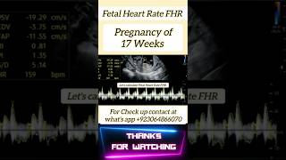 Fetal Heart Rate FHR in ultrasound shorts [upl. by Aelanej]