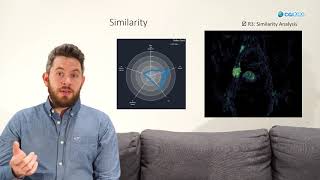 ParaGlyder Probedriven Interactive VisualAnalysis for Multiparametric Medical Imaging Data [upl. by Gnep188]