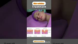 skin wrinkles treatment at home asmr ramdy for wrinkle [upl. by Cynde]